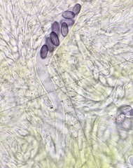 Ascobolus crenulatus