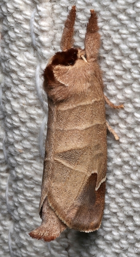 Sigmoid Prominent photo 5