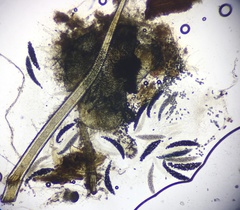 Podospora collapsa