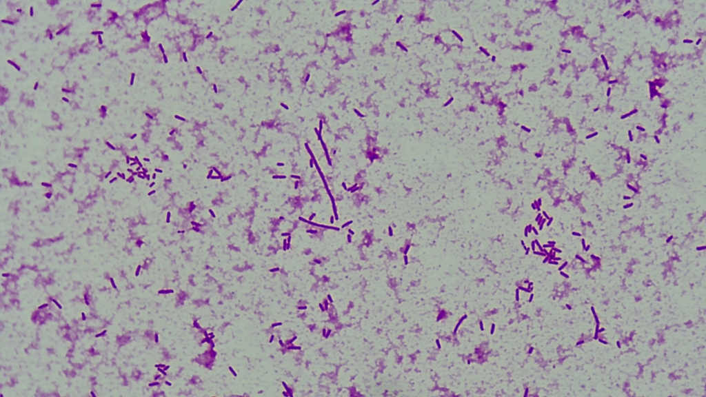 Pluralibacter