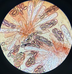 Saccobolus depauperatus