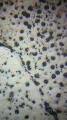 Bagliettoa parmigera