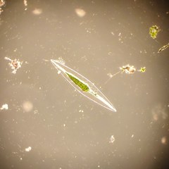 Closterium acerosum lanceolatum