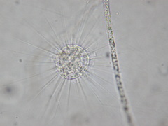 Actinosphaerium