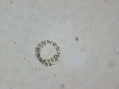 Anabaena