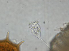 Vorticella