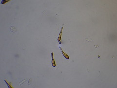 Puccinia magnusiana