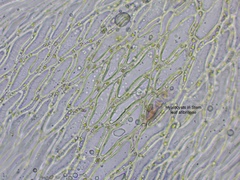 Sphagnum angustifolium