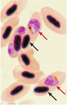 Plasmodium relictum