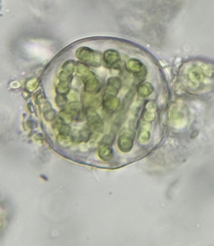 Cyanobacteria observed 2025-07-31