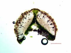 Rinodina parasitica