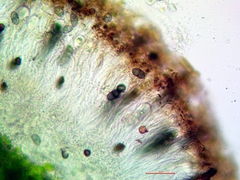 Rinodina parasitica