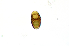 Rinodina parasitica