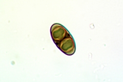 Rinodina parasitica