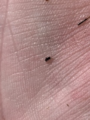 Microcylloepus