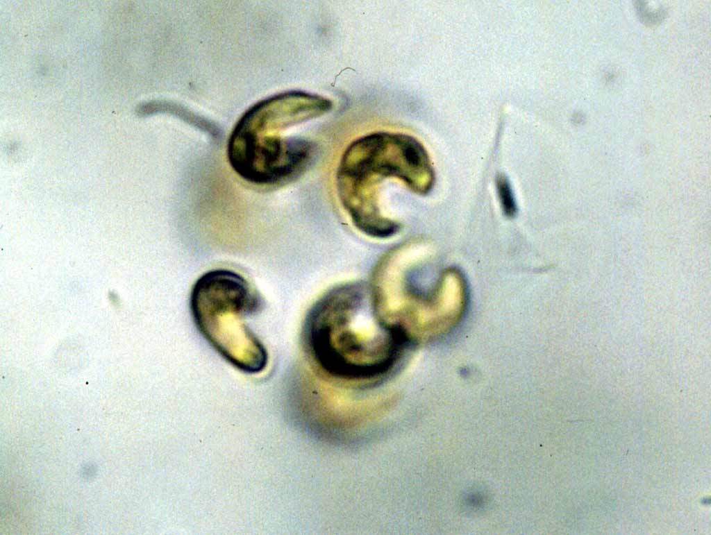 Kirchneriella lunaris