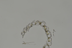 Sphagnum angustifolium