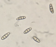 Hysterium angustatum