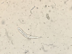 Hysterium angustatum