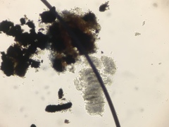 Hysterium angustatum