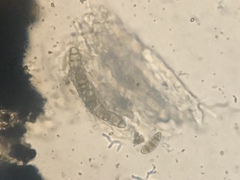 Hysterium angustatum