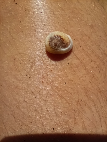 Tritia neritea