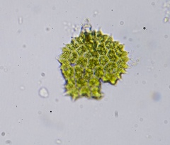 Pseudopediastrum boryanum