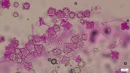 Hypomyces stephanomatis