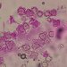 Hypomyces stephanomatis