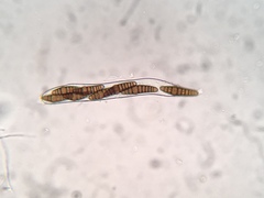 Oedohysterium sinense