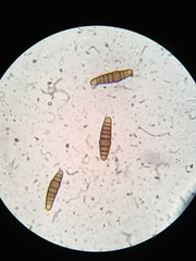 Oedohysterium sinense