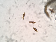 Oedohysterium sinense