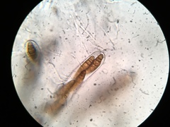 Oedohysterium sinense