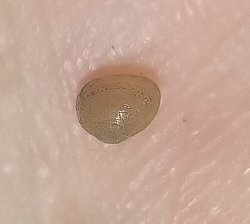 Pisidium milium observed 2025-08-08