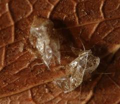 Retroacizzia mopanei