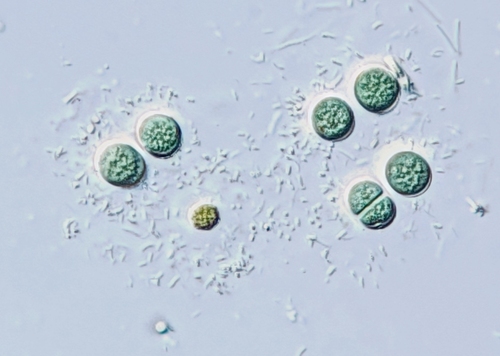 Chroococcus dispersus · iNaturalist United Kingdom