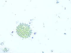 Hydrodictyaceae