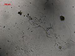 Acaulopage ischnospora