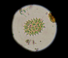 Pseudopediastrum boryanum