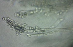 Penicillium italicum