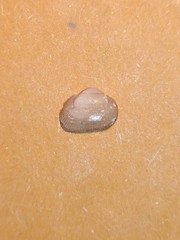 Striarca lactea