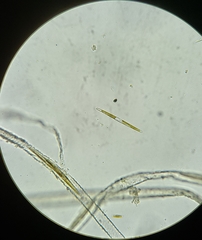 Nitzschia martiana