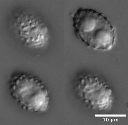 Peziza griseorosea