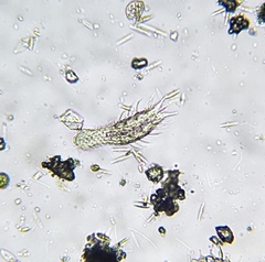 Gastrotricha