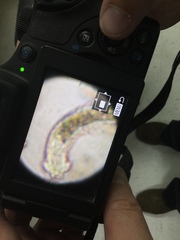 Gastrotricha