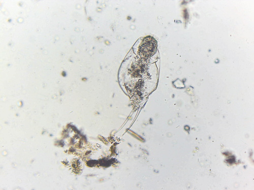Cephalodella gibba