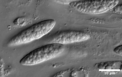 Flammocladiella anomiae
