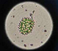 Pseudopediastrum boryanum