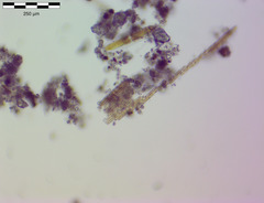 Bacillaria paxillifera