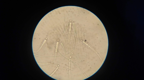 Gloeotrichia natans observed 2018-09-17